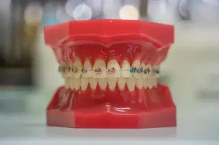 Orthodontie et appareils orthodontiques