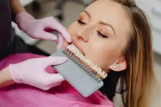 Blanchiment des dents
